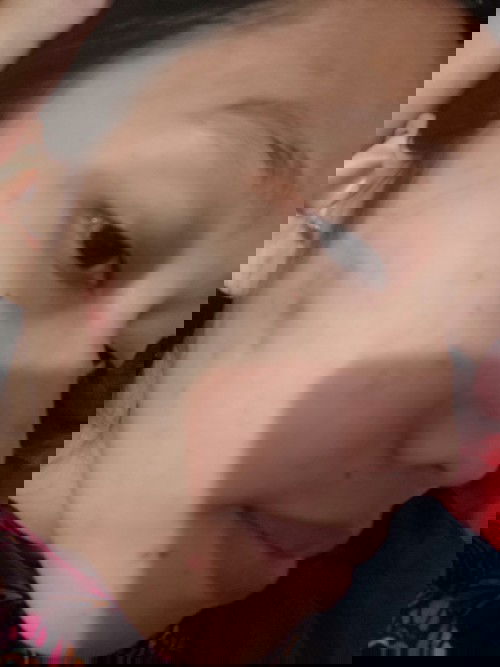 Muka berjerawat saat hamil