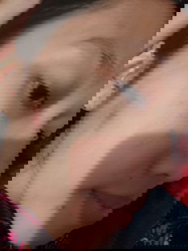 Muka berjerawat saat hamil