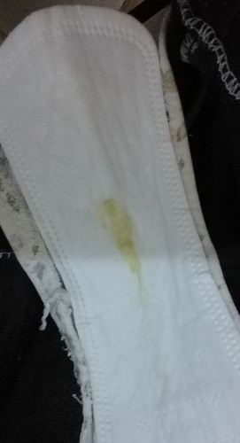 Momshies i have greenish discharge po. Bkit kaya?? 35weeksand3days preg.here. and i have uti po.