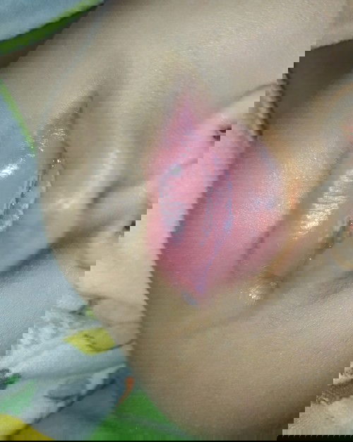 Bibir dan lidah bayi bercak putih