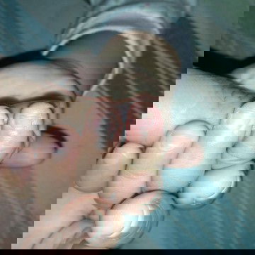 Namamalat saka namamaga