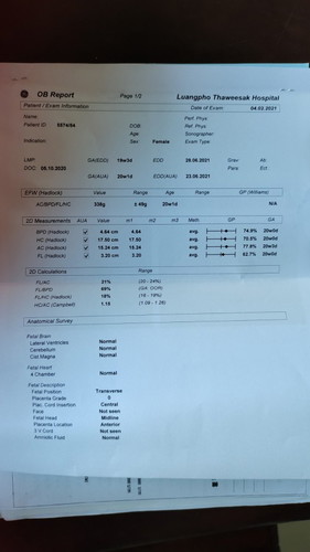 19w4d นน.330g ปกติมั้ย