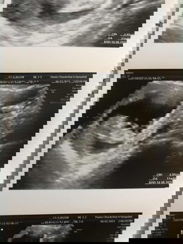 หนูเป็น ญ หรือ ช เอ่ย