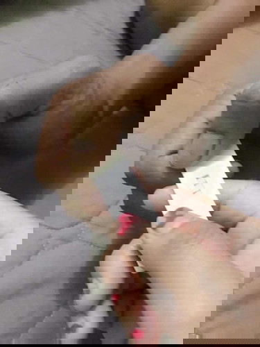 Gugur keluar darah Beku