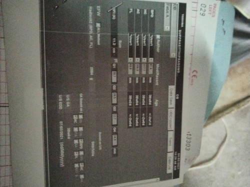 ผลอะไรมีใครรู้ไหมค่ะ ถ้ารู้บอกเราหน่อย