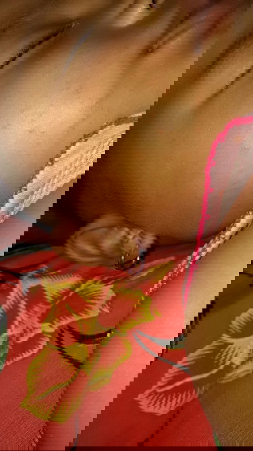 Bintik merah di kaki,tangan dan pipi