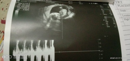 mga mommy ask ko lang po ok lng b n hnd ko iniinm yng binigy sakin na ferrus kmakain nmn ako ng glay