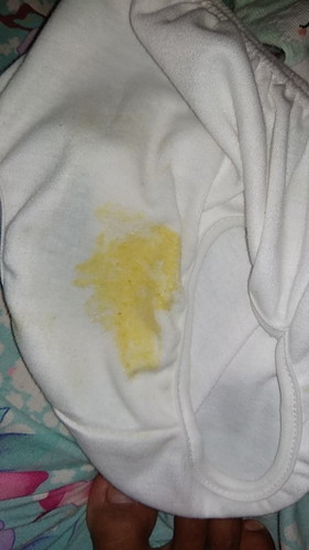 Kenapa muntah bayi warna nya kuning?apakah wajar?