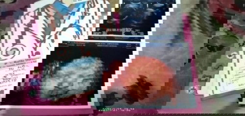 Menanti louncing baby