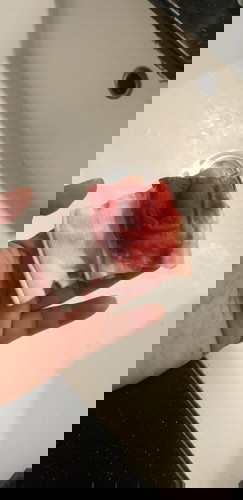 Red bleeding when wiping.