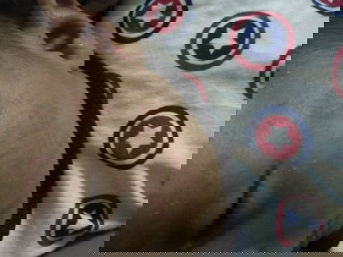 ตุ่มใสๆคล้ายหนอง