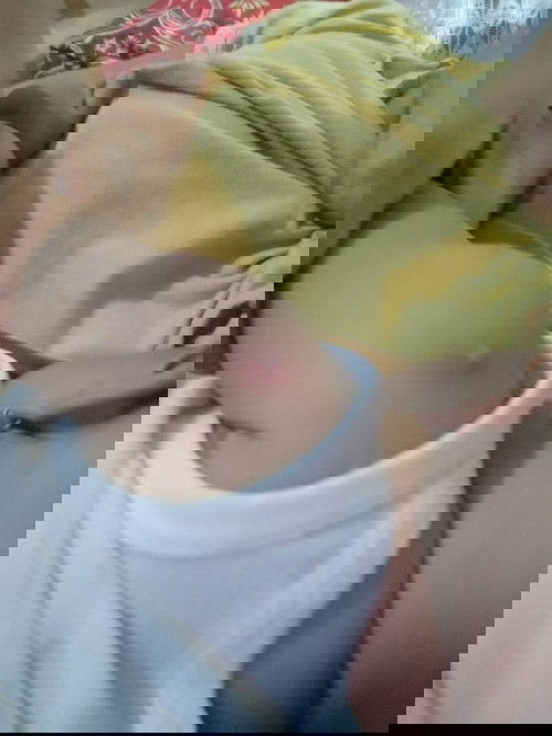 jerawat di lengan bayi