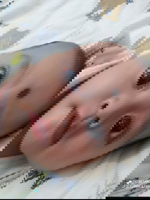 Bintik putih diwajah