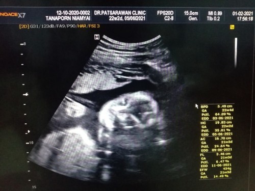 ขอเสียงแม่ๆทีมเดือนมิถุนาหน่อย