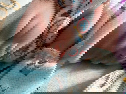 ความเจ็บปวดที่งดงาม