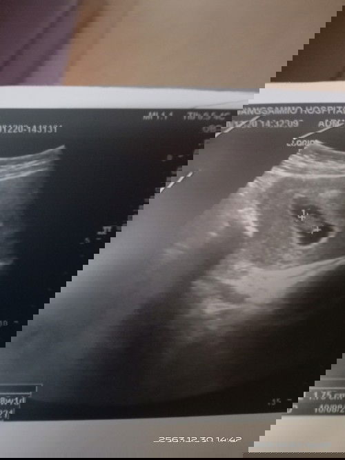 ท้องแรกขอคำแนะนำหน่อยค่ะ