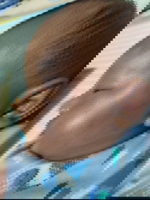 Bercak putih di wajah