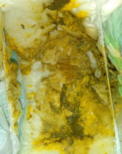 Hi moms out there,gani2 ba tlaga ang poop ng bby pg kumkain ng cerelac?