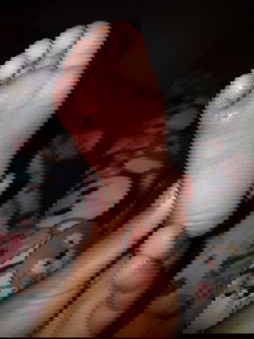 Kaki anak ku ini kenapa ya?