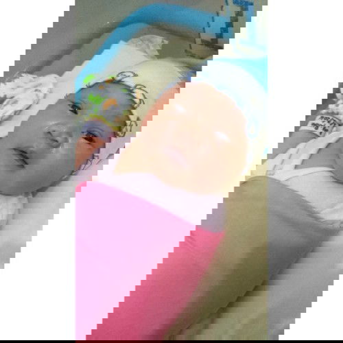 Bukaan lengkap ujung ujungnya operasi