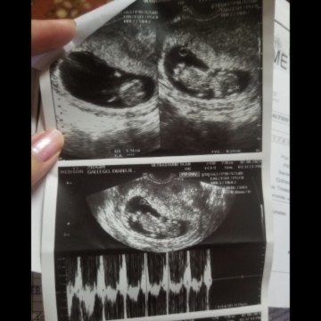 Ultrasound. Please check