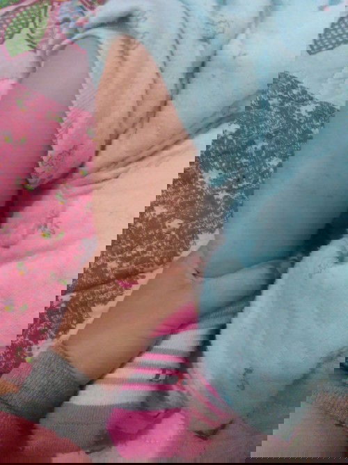 M.n cho e hỏi là bé nhà e bị như này là bị gì ạ ?