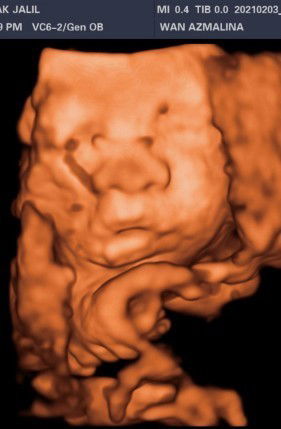 30w1d and counting...