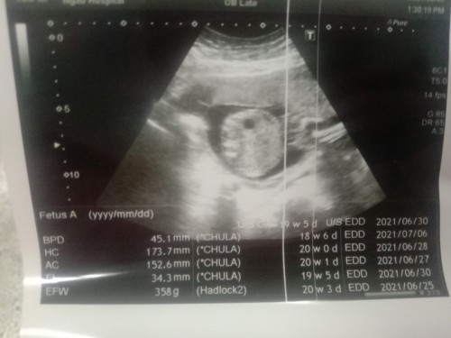 สอบถามหน่อยคะ