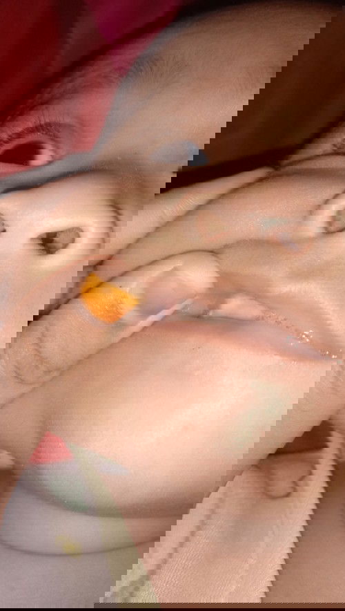 Titik putih seperti sariawan