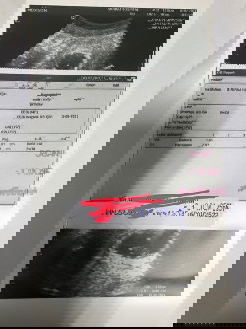 ซาวด์ 8 วีค ไม่เจอหัวใจเต้น