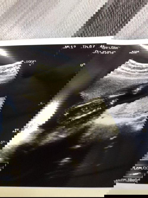 ผญ/ผช คะ☺️ 17w