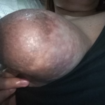 Is this normal for my pregnancy??
Super itchy po.. π
Lalong lumala Ngayon 3rd Trimester na.. ππ’π