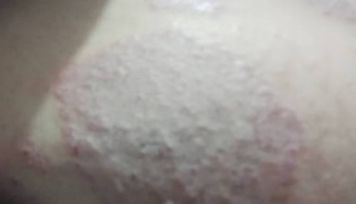 Bismillah dapet obat dan sembuh