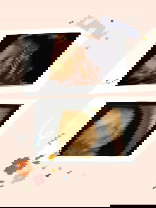 Hasil USG anak pertama & kedua