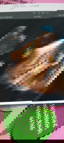 Bun saya hamil 31 minggu.. BB bayi 1.700,kata teman" BB segitu kecil, apa iya segitu itu kecil bunda