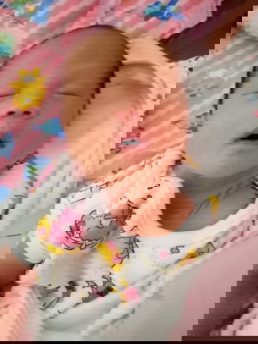 แตกแล้วแต่เราผ่าคลอด