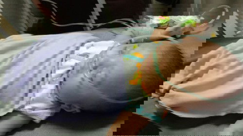 Bayi 2 bulan habis imunisasi, kejang