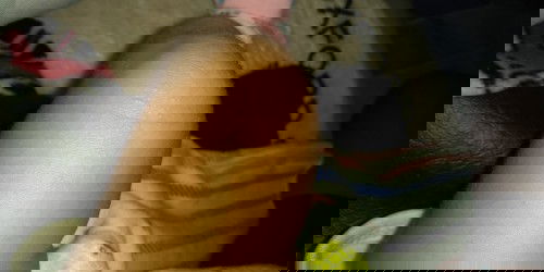 beruntusan pada bayi