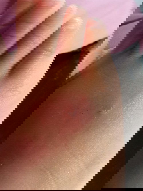 Mohon infonya masalah si kecil 🙏