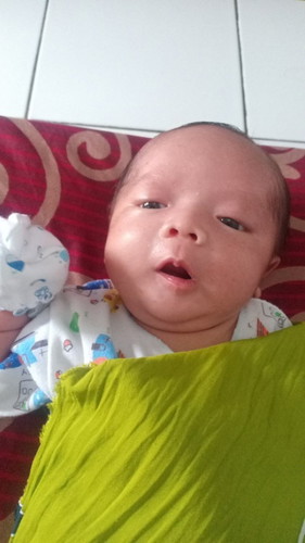 Pilek bayi 3 minggu