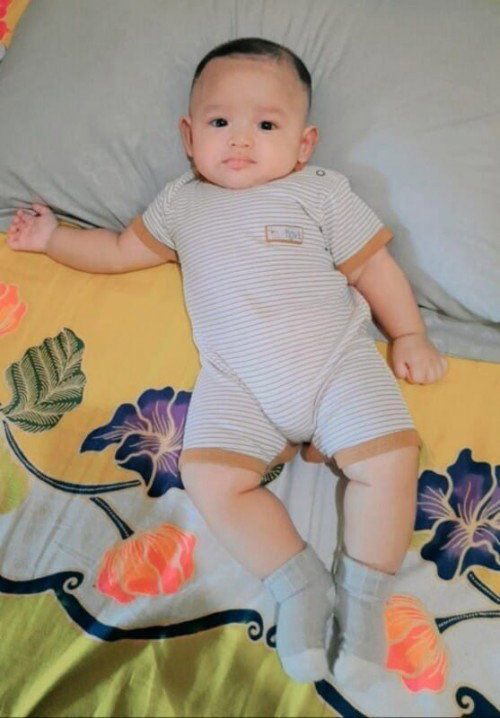 Sunat Bayi