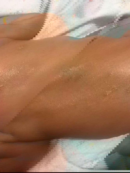 Seperti ringworm di badan