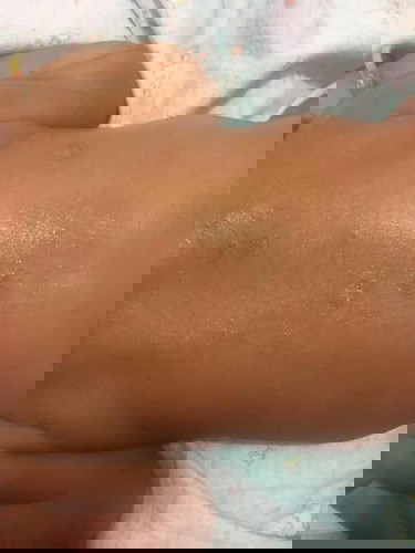 Seperti ringworm di badan