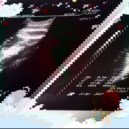 แม่ๆที่มีประสบการณ์ช่วยแนะนำวิธีการดูใบซาวด์หน่อยค่า🥰