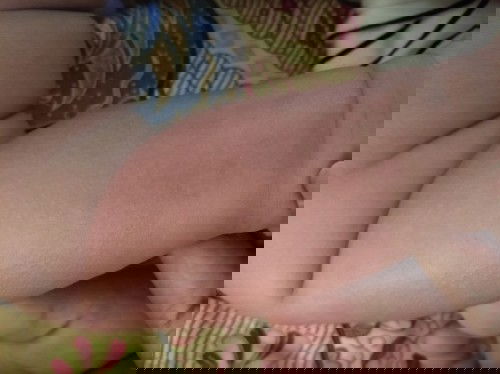 Aleegi kaki pada bayi