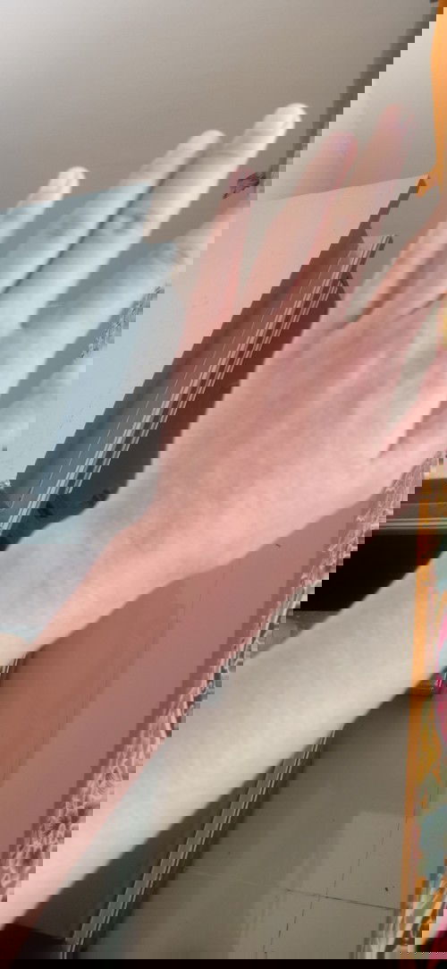 Muntah badan jadi gatal dan bengkak