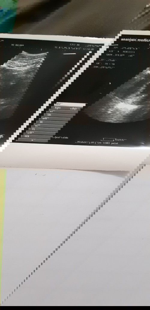 Wajar gk?? Ada yg sama?