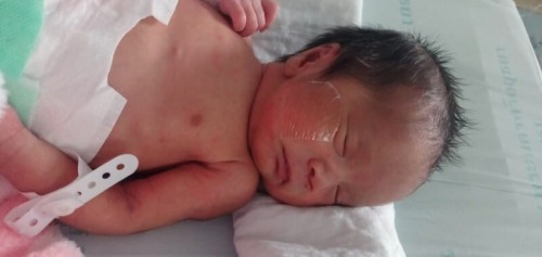 💣🎉🎉ครรภ์เป็นพิษ/คุณแม่ความดันสูงผ่าคลอดก่อนกำหนด✌️✌️🎊🎊