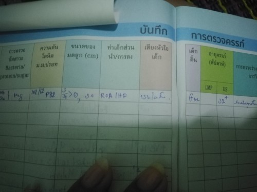 สอบถามผู้รู้ค่ะ