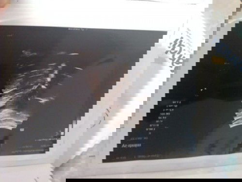 Kehamilan dan telat haid